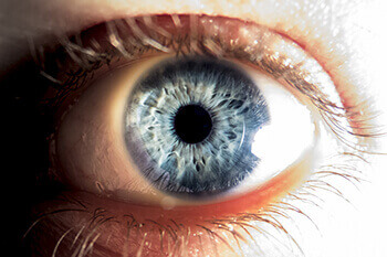 Closeup of a Cornea